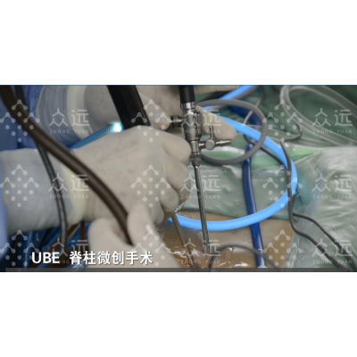 UBE技术、UBE器械包、UBE手术器械