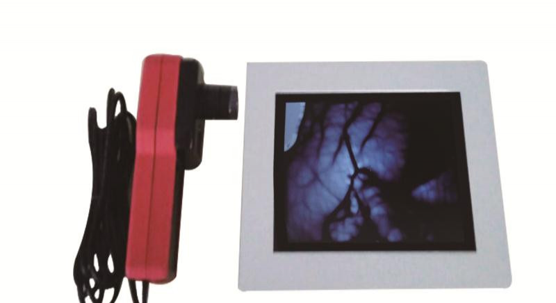 东发医疗厂家招商DF-700静脉显像仪血管显像仪 静脉定位仪
